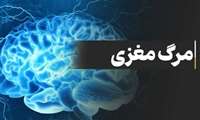 هفته ملی اهدای عضو؛ مکانیسم مرگ مغزی